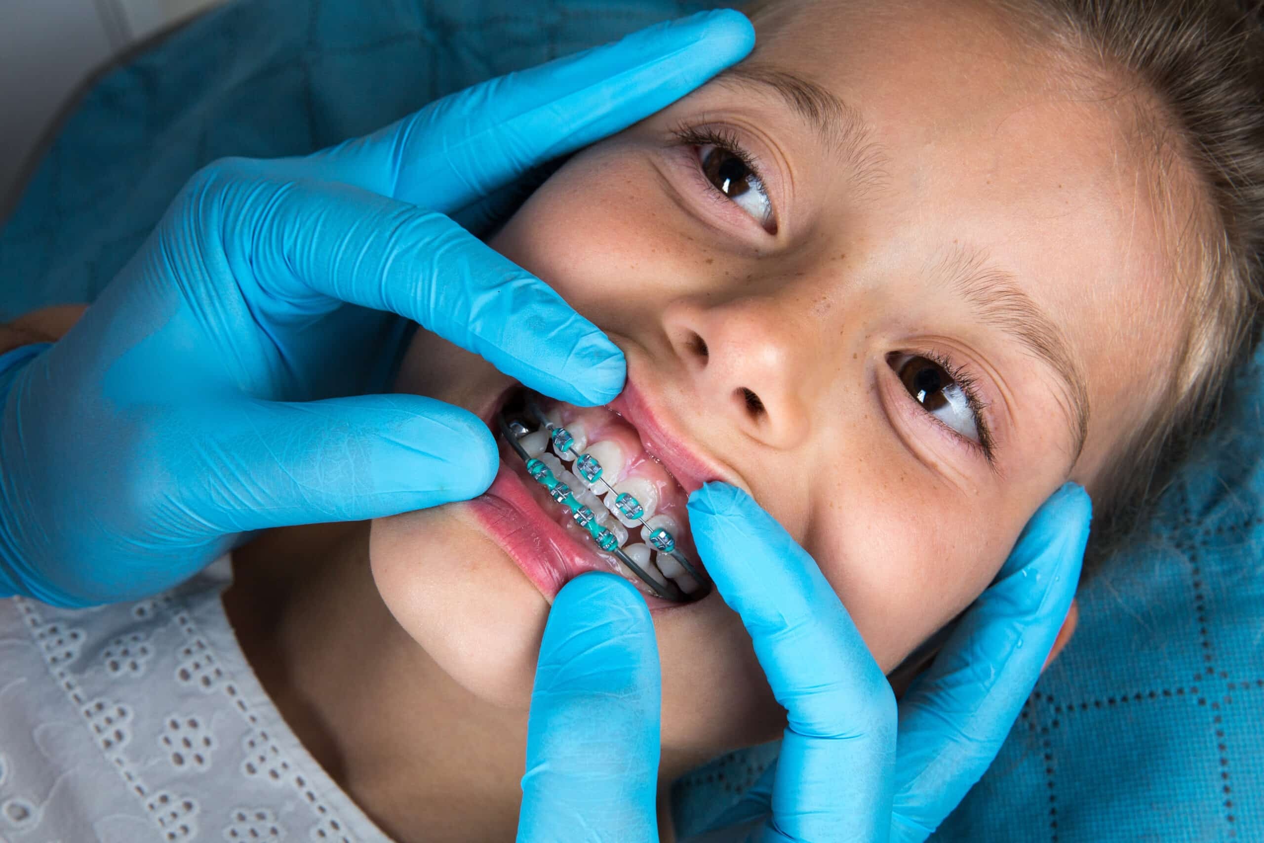 Children’s Orthodontics Braces, Aligners, and Beyond